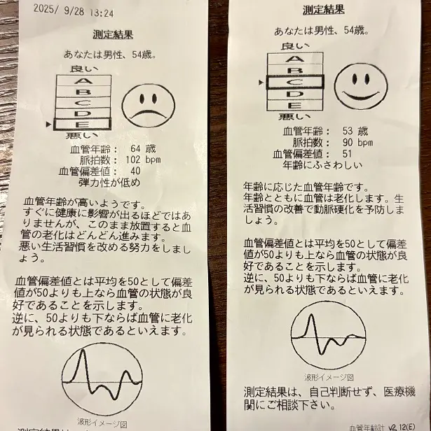 血管年齢の測定結果シート